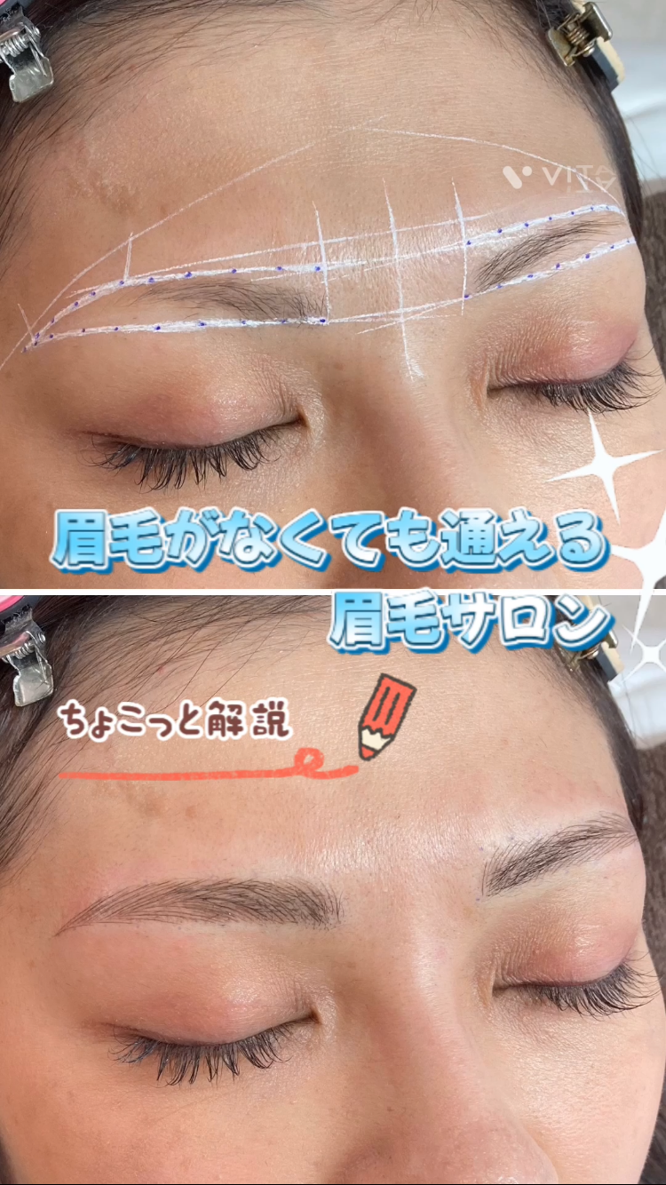 ダウンロード